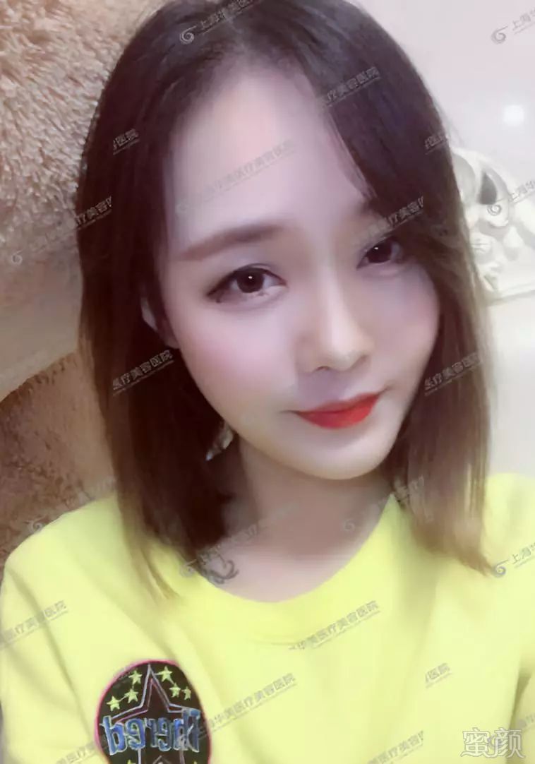 https://img.miyanlife.com/mnt/timg/181217/114HS332-6.jpg