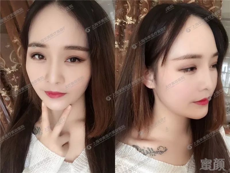 https://img.miyanlife.com/mnt/timg/181217/114HSO3-4.jpg