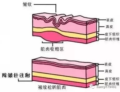 案例图片