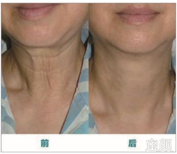 https://img.miyanlife.com/mnt/timg/181217/1204293536-10.jpg