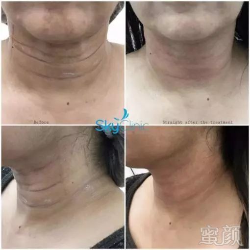 https://img.miyanlife.com/mnt/timg/181217/1204295314-15.jpg