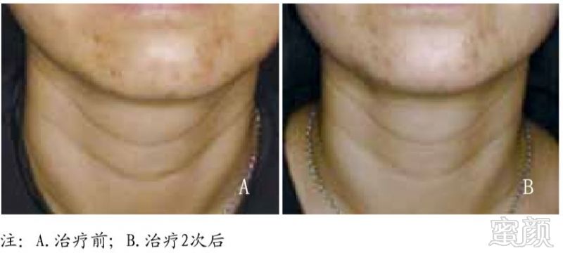 https://img.miyanlife.com/mnt/timg/181217/120429AH-12.jpg