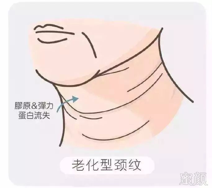 https://img.miyanlife.com/mnt/timg/181217/12042I025-2.jpg