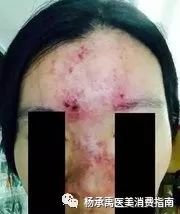 https://img.miyanlife.com/mnt/timg/181217/125649CR-1.jpg