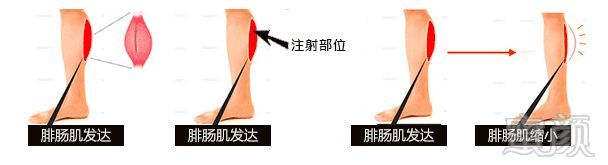 https://img.miyanlife.com/mnt/timg/181218/1222501P9-4.jpg
