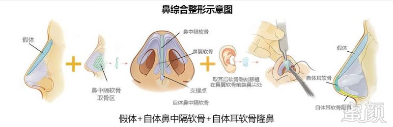 案例图片