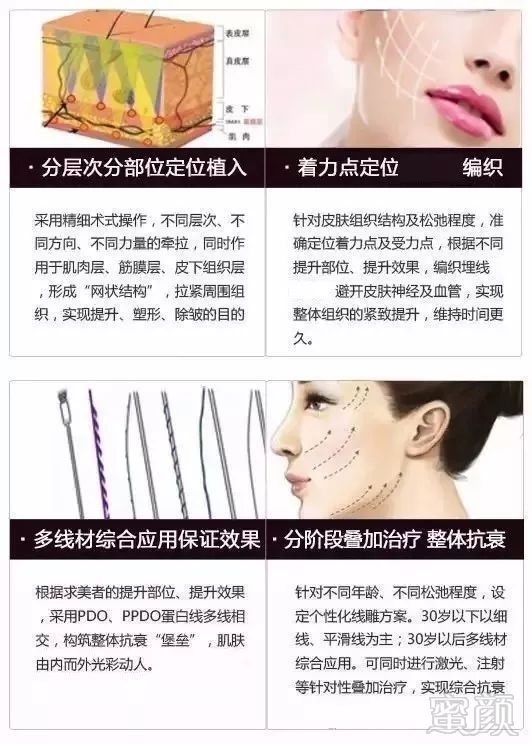 https://img.miyanlife.com/mnt/timg/181219/122631L61-5.jpg
