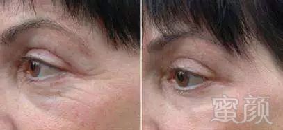 https://img.miyanlife.com/mnt/timg/181220/10453I434-3.jpg