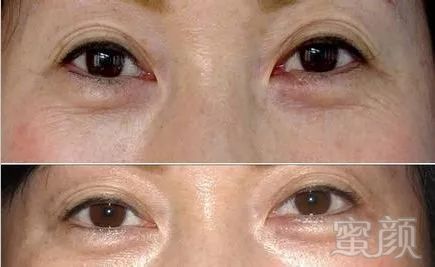 https://img.miyanlife.com/mnt/timg/181220/10453L432-1.jpg