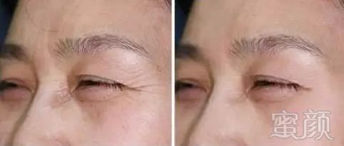 https://img.miyanlife.com/mnt/timg/181220/10453LJ0-2.jpg