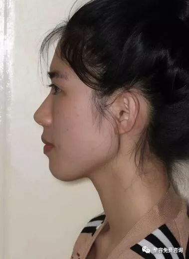 https://img.miyanlife.com/mnt/timg/181220/11493BZ0-5.jpg