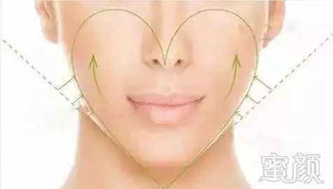 https://img.miyanlife.com/mnt/timg/181220/12001A921-4.jpg