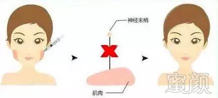 https://img.miyanlife.com/mnt/timg/181220/12113LA3-7.jpg
