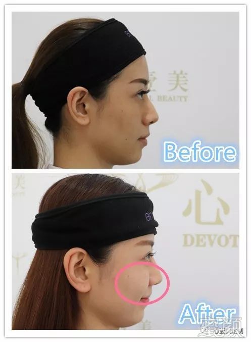 https://img.miyanlife.com/mnt/timg/181220/1214135356-11.jpg