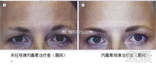 https://img.miyanlife.com/mnt/timg/181220/121FAU3-1.jpg
