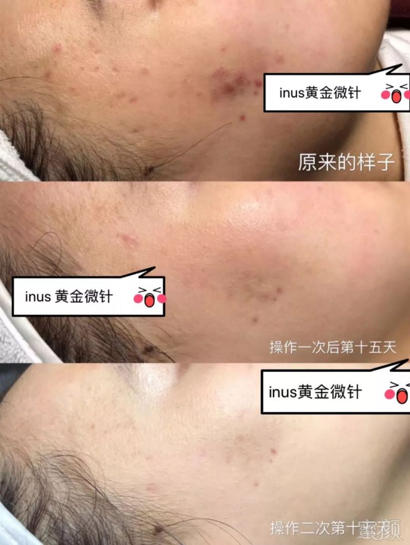 https://img.miyanlife.com/mnt/timg/181220/122U52225-14.jpg