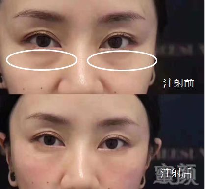 https://img.miyanlife.com/mnt/timg/181220/1306125M6-5.jpg
