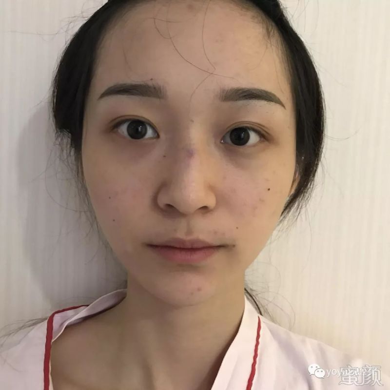 https://img.miyanlife.com/mnt/timg/181221/1129233600-0.jpg