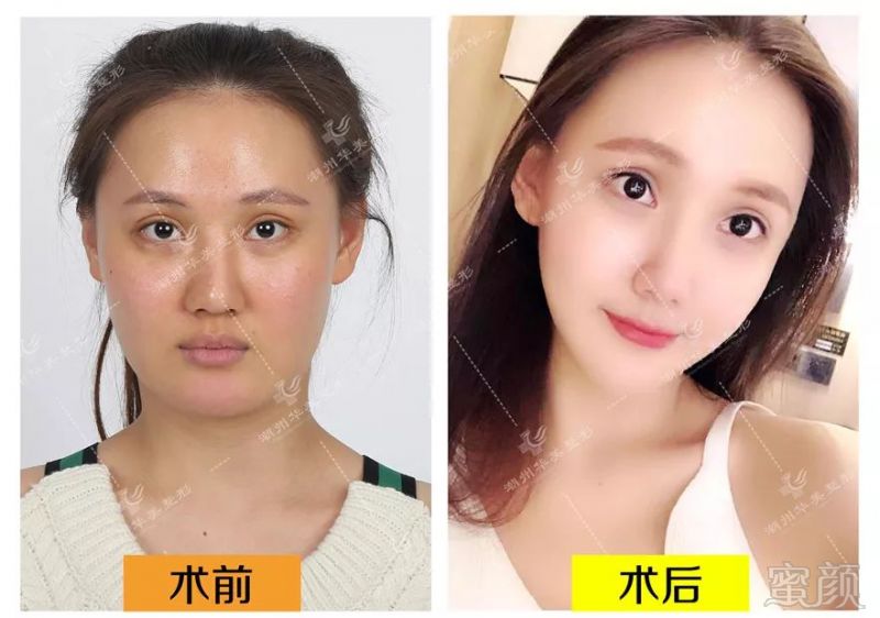 https://img.miyanlife.com/mnt/timg/181221/11305961L-7.jpg