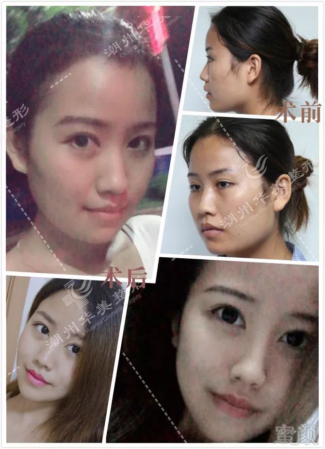 https://img.miyanlife.com/mnt/timg/181221/1130596308-5.jpg