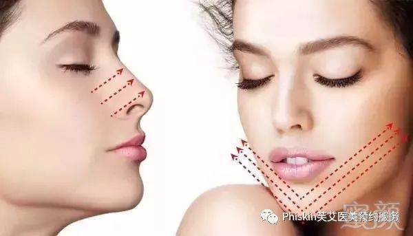 https://img.miyanlife.com/mnt/timg/181221/1131541545-3.jpg