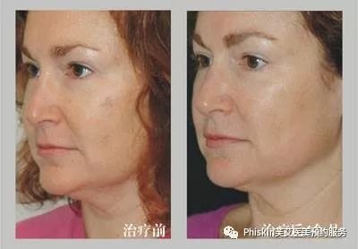 https://img.miyanlife.com/mnt/timg/181221/1131541556-4.jpg