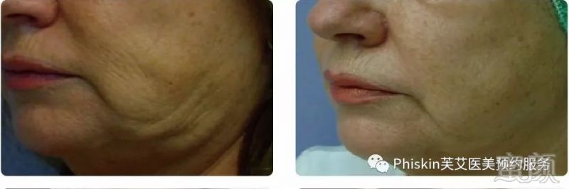 https://img.miyanlife.com/mnt/timg/181221/1131556040-6.jpg