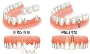 案例图片