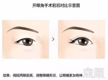 https://img.miyanlife.com/mnt/timg/181221/1304392127-4.jpg