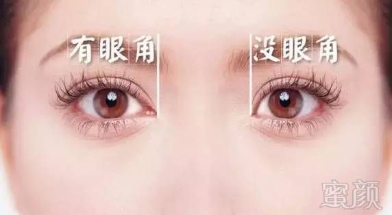 https://img.miyanlife.com/mnt/timg/181221/1304394622-0.jpg