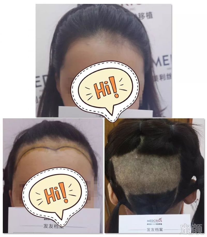https://img.miyanlife.com/mnt/timg/181221/130F32093-0.jpg
