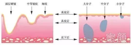 https://img.miyanlife.com/mnt/timg/181221/1335134U1-5.jpg