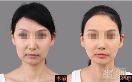https://img.miyanlife.com/mnt/timg/181222/11225J011-6.jpg