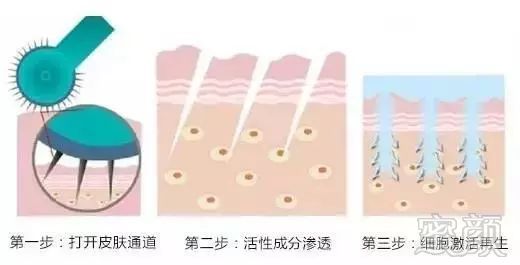 https://img.miyanlife.com/mnt/timg/181222/11325B2V-0.jpg