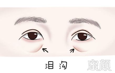 https://img.miyanlife.com/mnt/timg/181222/11504410U-0.jpg