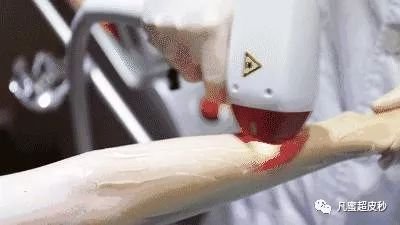 https://img.miyanlife.com/mnt/timg/181223/11103Vb6-1.jpg