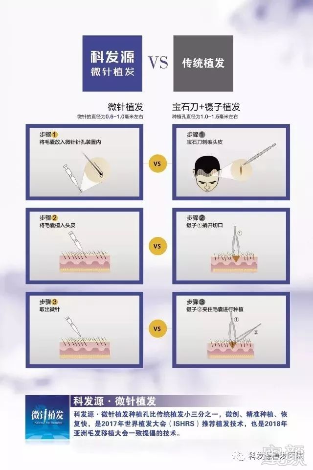 https://img.miyanlife.com/mnt/timg/181223/1121443S3-3.jpg