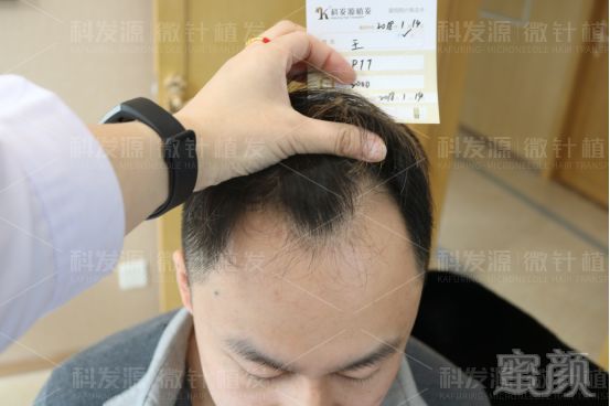 https://img.miyanlife.com/mnt/timg/181223/1121444V3-4.jpg