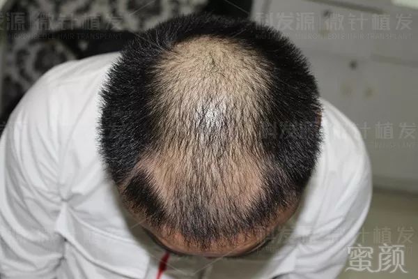 https://img.miyanlife.com/mnt/timg/181223/1121445B7-5.jpg