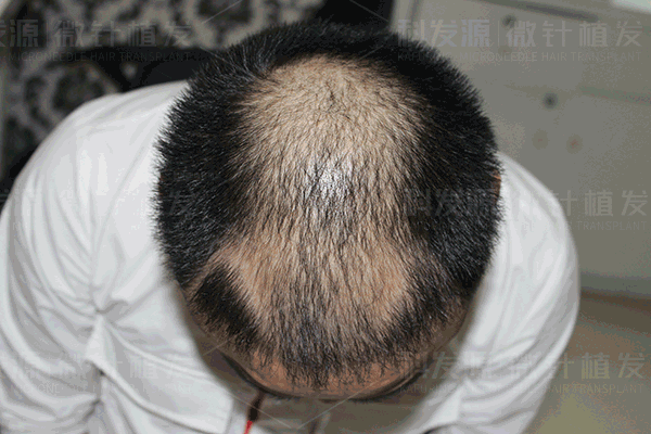 https://img.miyanlife.com/mnt/timg/181223/1121445F7-7.jpg