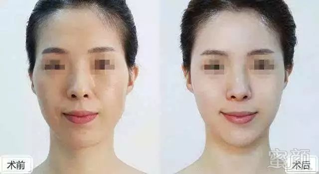 https://img.miyanlife.com/mnt/timg/181223/112Ha608-7.jpg