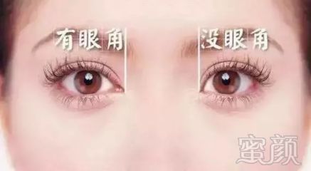 https://img.miyanlife.com/mnt/timg/181223/113241JO-3.jpg