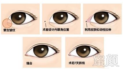 https://img.miyanlife.com/mnt/timg/181223/113242E28-7.jpg