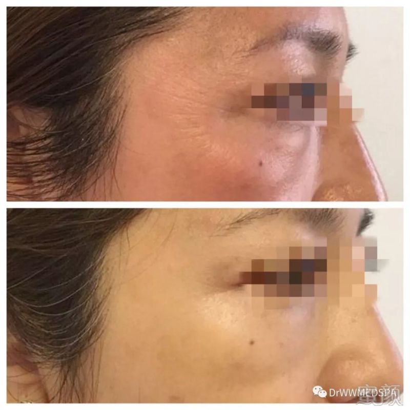 https://img.miyanlife.com/mnt/timg/181223/13492a392-0.jpg