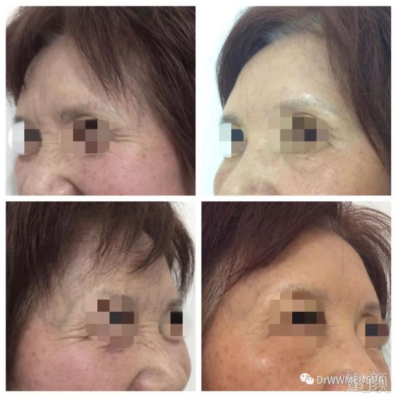 https://img.miyanlife.com/mnt/timg/181223/1349301364-3.jpg