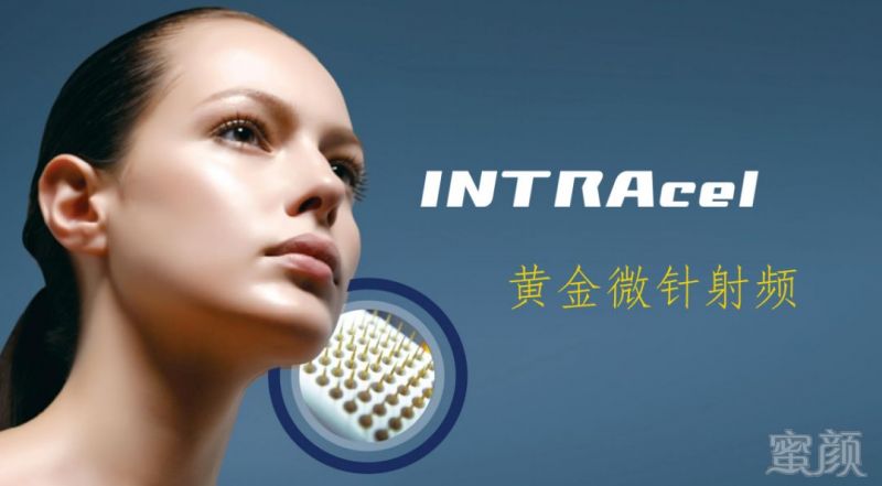 https://img.miyanlife.com/mnt/timg/181224/1229152116-0.jpg
