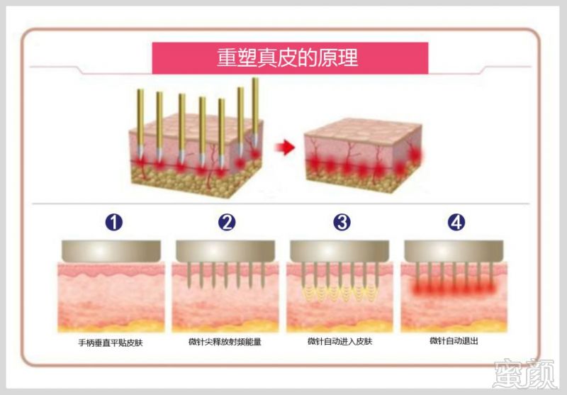 https://img.miyanlife.com/mnt/timg/181224/1229161215-4.jpg