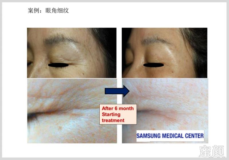 https://img.miyanlife.com/mnt/timg/181224/1229163305-7.jpg