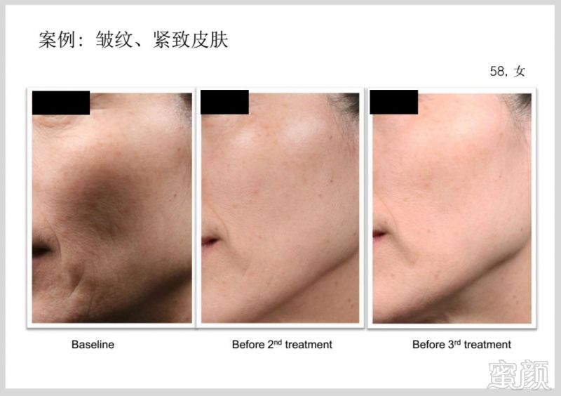 https://img.miyanlife.com/mnt/timg/181224/1229163P5-9.jpg