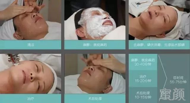 https://img.miyanlife.com/mnt/timg/181224/1229164Y4-5.jpg